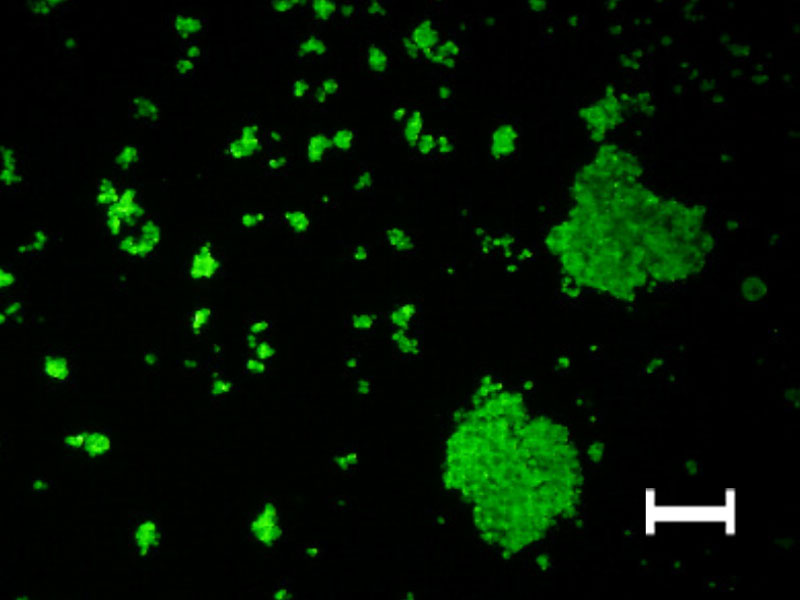 (A) Cells trapped using the 20 µm mesh