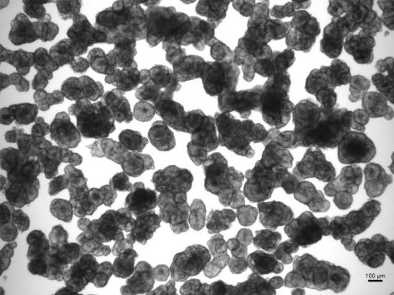 図1: KUC6細胞塊懸濁液の顕微鏡写真。直径40 µm以上の細胞塊が見られます。スケールバーは100μm。